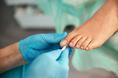 Tıbbî pedikür yapan doktorlara yaklaş.