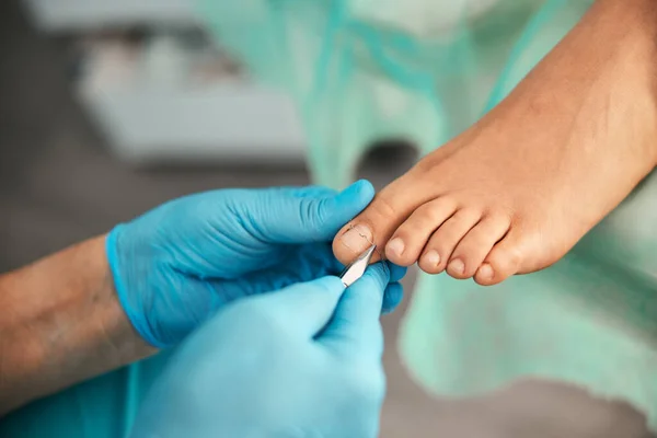 Close up of doctor doing medical pedicure — Stock Photo, Image