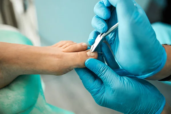 Focused photo on male hands holding nail clippers — Stock Photo, Image