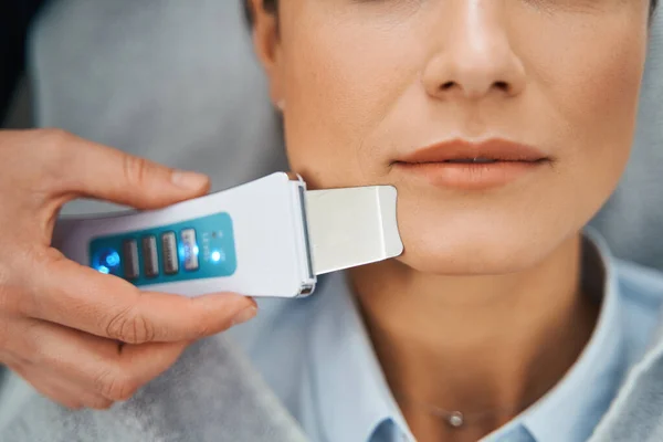 Patienten får sina porer avtäppta med en ultraljudshud spatel — Stockfoto