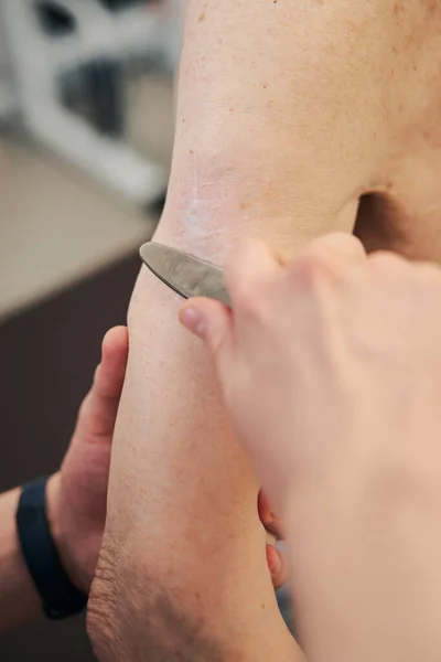 Arzt kratzt Seniorin mit Gua-sha-Werkzeug am Arm — Stockfoto