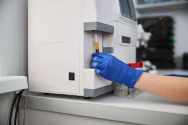 Biyokimyacı hematoloji analizcisi kullanarak hematolojik test yapıyor.