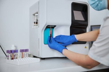 Laboratuvar teknisyeni hematolojik test yapıyor.