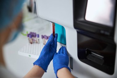 Laboratuvar teknisyeni bir hematoloji analizcisi üzerinde biyokimyasal analiz yapıyor.
