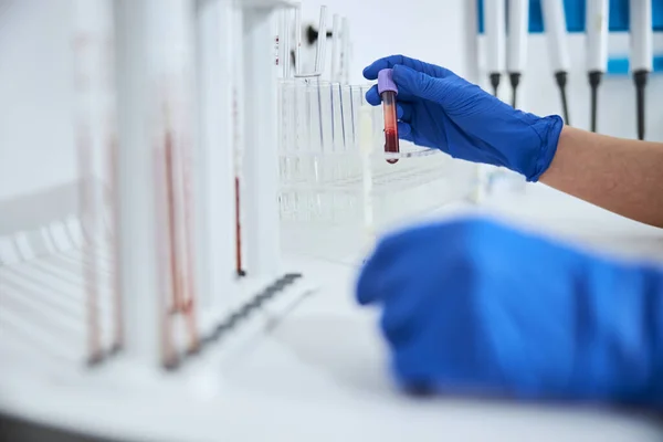 Vědec v latexových rukavicích se skleněnou injekční lahvičkou s levandulovým uzávěrem — Stock fotografie