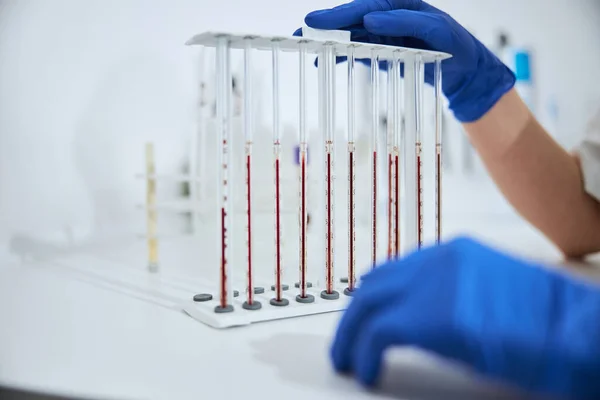 Biochemist examining a set of calibrated pipettes — Stock Photo, Image