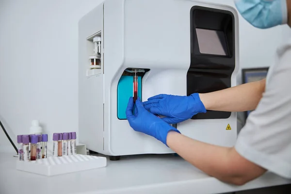 Laboratorietekniker som utför ett hematologiskt test — Stockfoto