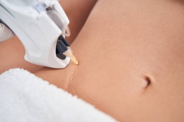 Klinikte vücudundaki yarayı temizleyen kadın.