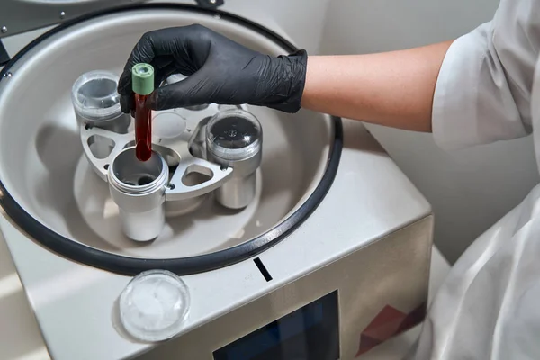Erfaren läkare som förbereder en trombocytrik plasma för anti-aging behandling — Stockfoto