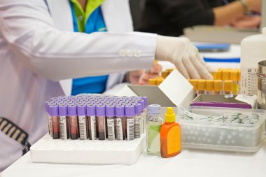 bir hemşire, bir tepsi üzerinde kan olan test tüpleri düzenler