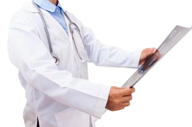 Doktor röntgeni inceliyor.