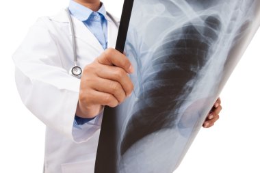 Doktor röntgeni inceliyor.