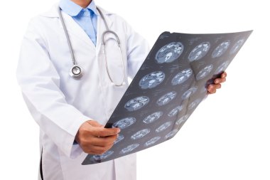 Doktor röntgeni inceliyor.