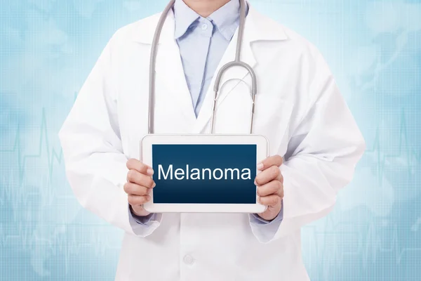 Medico con segno di melanoma — Foto Stock