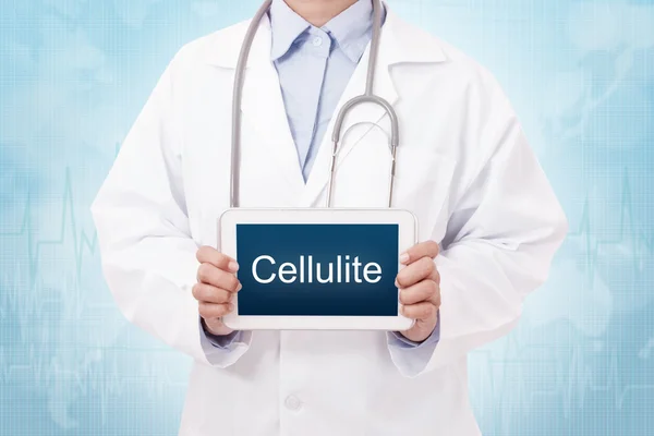 Doctor with cellulite sign — Stock Photo, Image