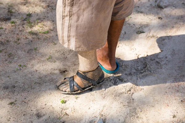 Image of a prosthesis leg in rural Cambodia.