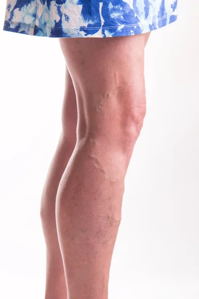 Varis legsv üzerinde