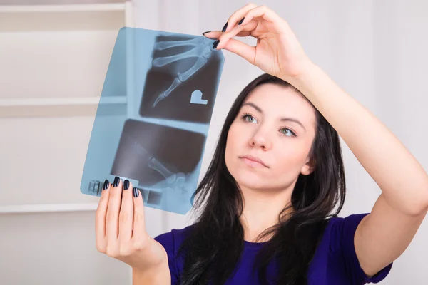 Девушка держит рентгеновское изображение — стоковое фото