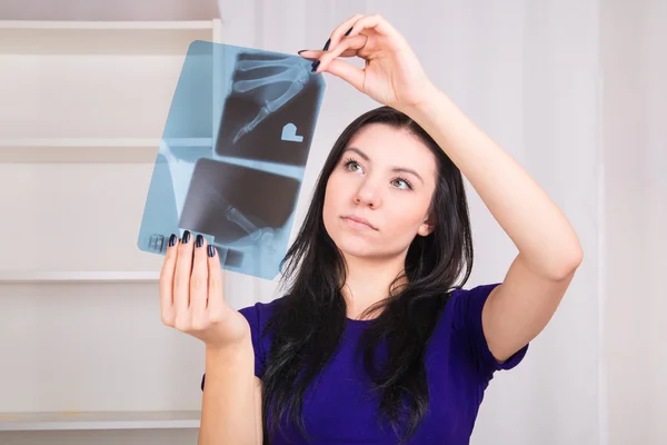 Girl holding x-ray image — Stock Photo, Image