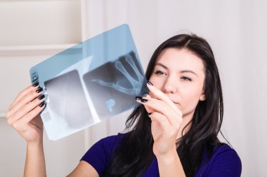 X-ray görüntü tutan kız