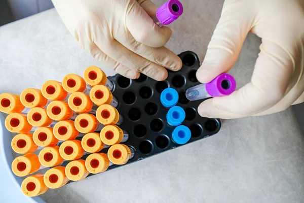 Nurse work with test tubes. Top view, hands in gloves, colored tubes