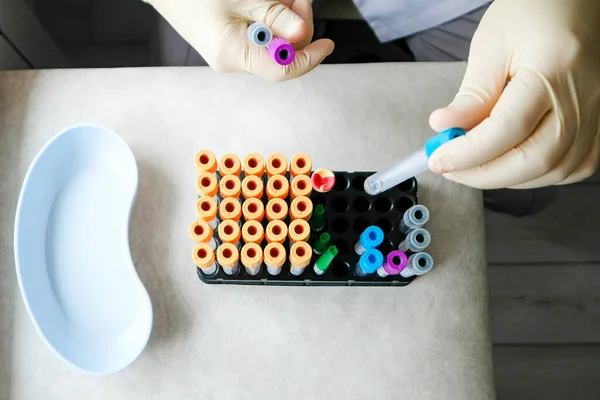 Nurse Work Test Tubes Top View Hands Gloves Colored Tubes — Stock Photo, Image