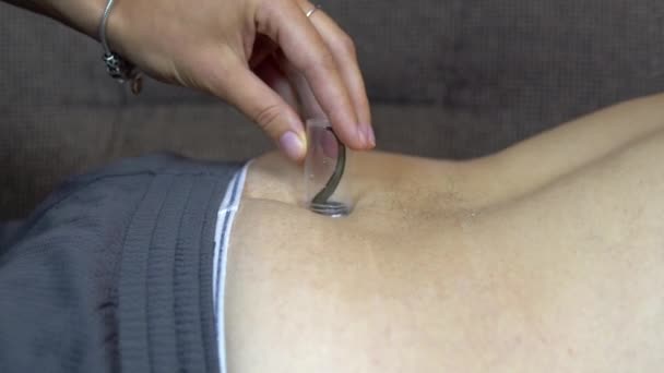 Uma sanguessuga é colocada na coxa do homem. Procedimentos de tratamento com sanguessugas — Vídeo de Stock