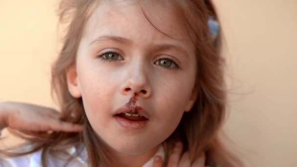 Belle rousse fille avec une lèvre douloureuse vous regarde — Video