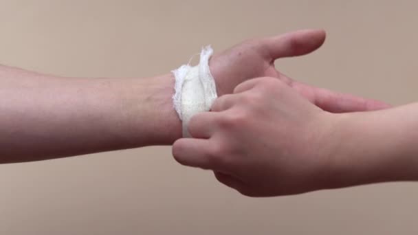 Skala av gipset från en mans hand. Ett sår eller sår på armen. Sårbehandling — Stockvideo