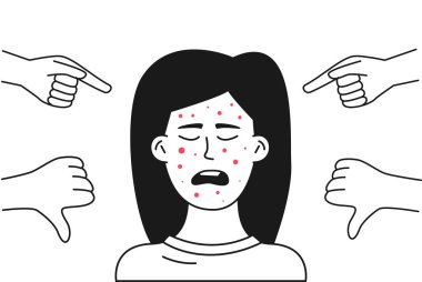 Yüzünde sivilce olan bir genç alay konusu olur. Görünüşleri yüzünden bir çocuğa zorbalık yapıyorlar..