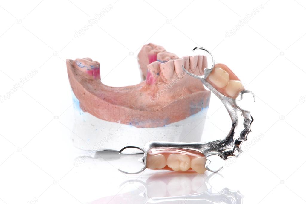 Denture mold,false teeth on white background.
