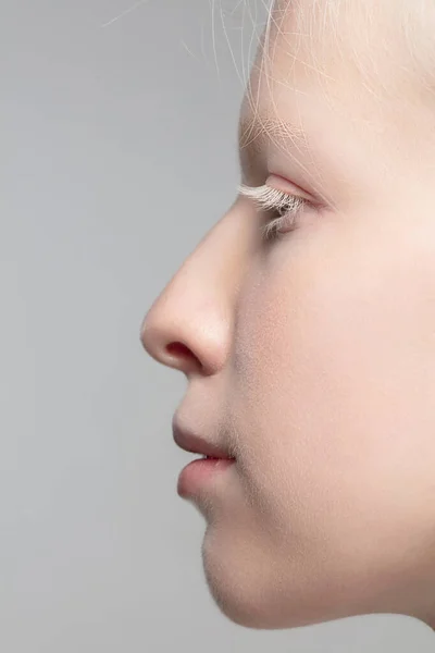 Primer plano retrato de hermosa mujer albina aislado en el fondo del estudio. Belleza, moda, cuidado de la piel, concepto de cosméticos. Detalles. —  Fotos de Stock