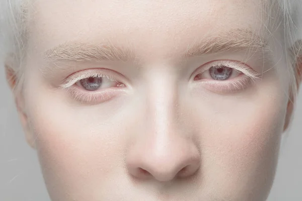 Close up portrait of beautiful albino woman isolated on studio background. Beauty, fashion, skincare, cosmetics concept. Details. — Stock Photo, Image