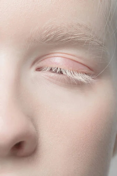 Ritratto ravvicinato di bella donna albina isolata su sfondo studio. Bellezza, moda, cura della pelle, concetto di cosmetici. Dettagli. — Foto Stock