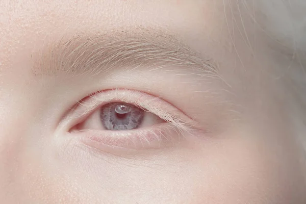 Close up portrait of beautiful albino woman isolated on studio background. Beauty, fashion, skincare, cosmetics concept. Details. — Stock Photo, Image