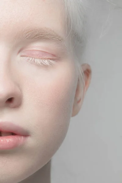 Close up portrait of beautiful albino woman isolated on studio background. Beauty, fashion, skincare, cosmetics concept. Details. — Stock Photo, Image