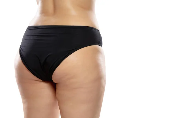 Överviktig kvinna med fett celluliter ben och skinkor, fetma kvinnlig kropp i svarta underkläder isolerad på vit bakgrund — Stockfoto