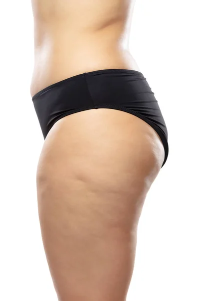 Mujer con sobrepeso, piernas y nalgas de celulitis grasa, cuerpo femenino con obesidad en ropa interior negra aislada sobre fondo blanco —  Fotos de Stock