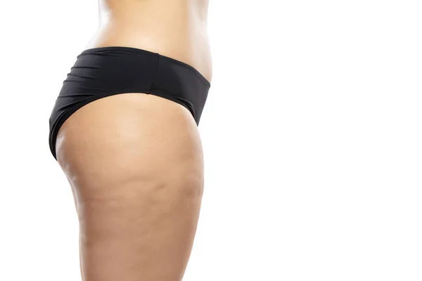Mulher com excesso de peso com pernas e nádegas de celulite gorda, corpo feminino obesidade em roupa interior preta isolado no fundo branco — Fotografia de Stock