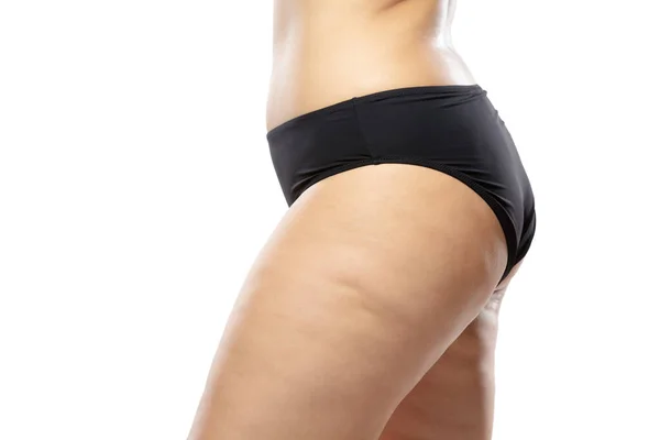 Femme en surpoids avec des jambes et des fesses en cellulite grasse, corps féminin en sous-vêtements noirs isolés sur fond blanc — Photo