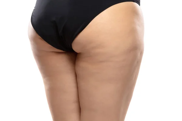 Übergewichtige Frau mit fetten Cellulite-Beinen und Gesäß, Fettleibigkeit weiblichen Körper in schwarzer Unterwäsche isoliert auf weißem Hintergrund — Stockfoto