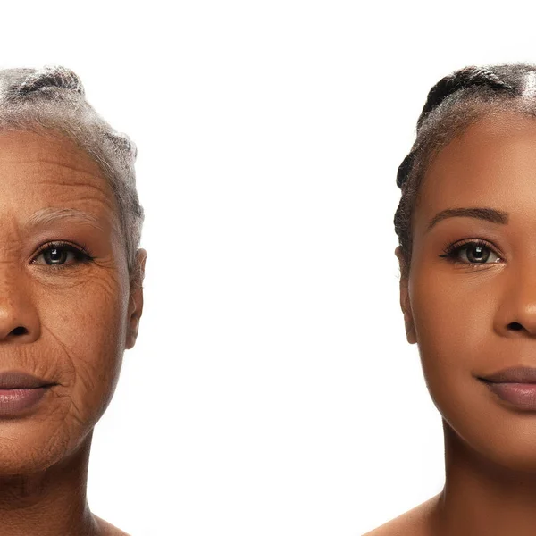 Comparison. Portrait of beautiful woman with problem and clean skin, aging and youth concept, beauty treatment and lifting. — Stock Photo, Image