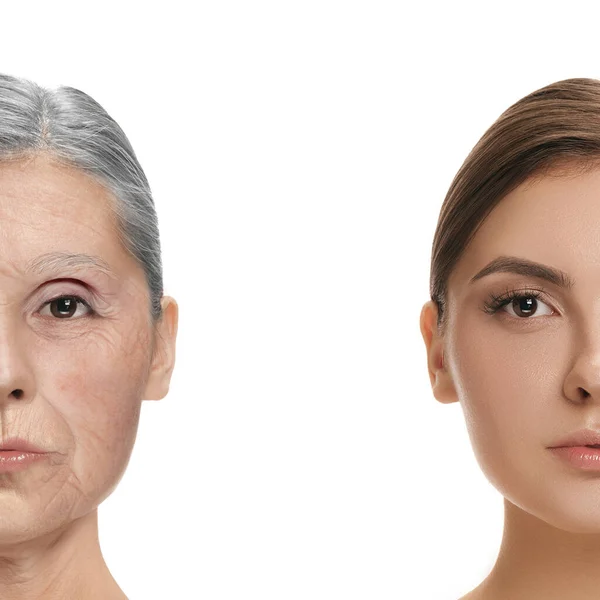 Comparison. Portrait of beautiful woman with problem and clean skin, aging and youth concept, beauty treatment and lifting. — Stock Photo, Image