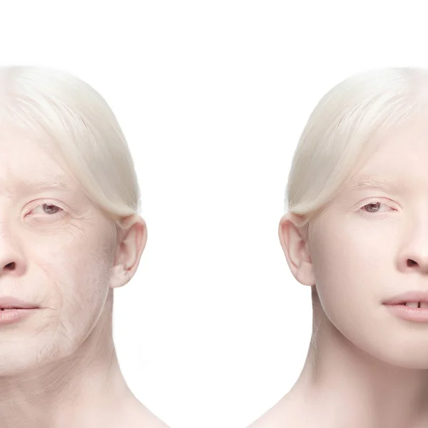 Összehasonlítás. Portré gyönyörű nő problémákkal és tiszta bőr, öregedés és az ifjúság koncepció, kozmetikai kezelés és emelés. — Stock Fotó