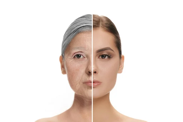Comparison. Portrait of beautiful woman with problem and clean skin, aging and youth concept, beauty treatment and lifting. — Stock Photo, Image