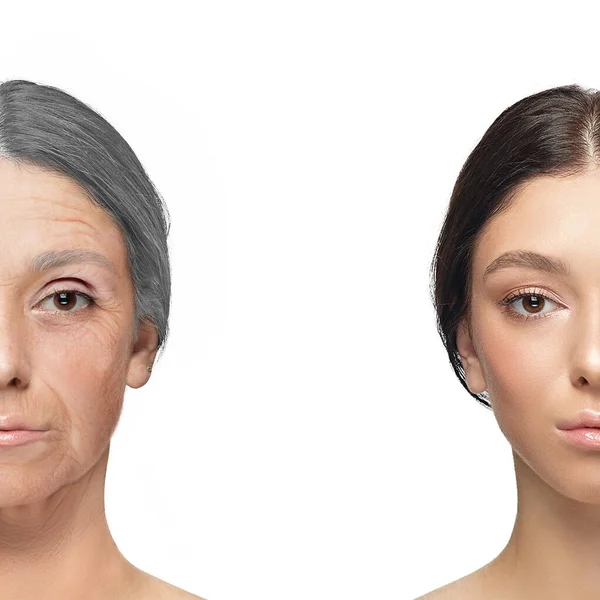 Сравнение. Портрет красивой женщины с проблемой и чистой кожей, старение и молодежь концепция, косметические процедуры и подъем. — стоковое фото