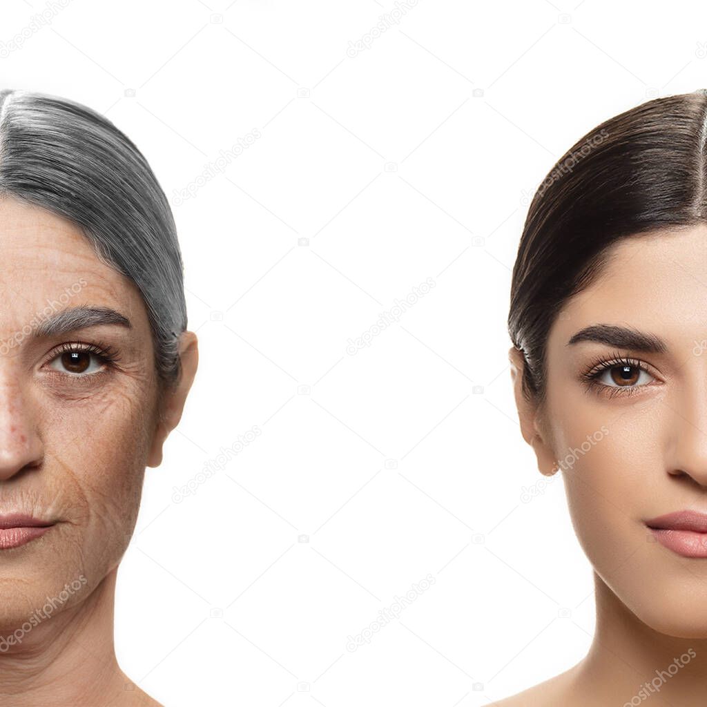 Comparison. Portrait of beautiful woman with problem and clean skin, aging and youth concept, beauty treatment and lifting.