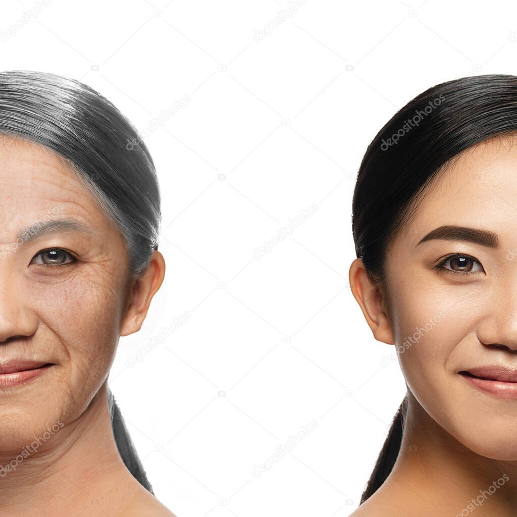 Comparison. Portrait of beautiful woman with problem and clean skin, aging and youth concept, beauty treatment and lifting.