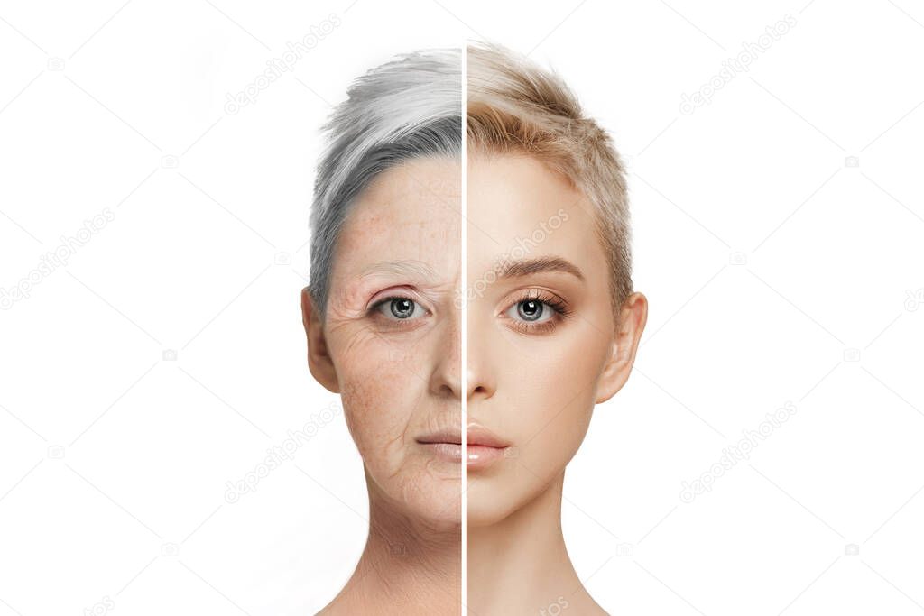 Comparison. Portrait of beautiful woman with problem and clean skin, aging and youth concept, beauty treatment and lifting.