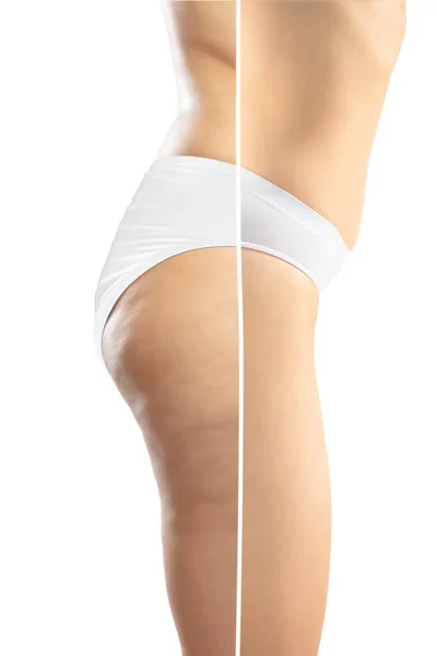 Nadváha žena s tlustou celulitidou nohy a hýždě, obezita ženské tělo v bílém prádle ve srovnání s fit a tenké tělo izolované na bílém pozadí — Stock fotografie